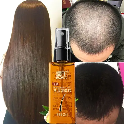 bawang hair oil, anti hair loss liquid, hair growth essence, hair care liquid, anti hair fall spray, scalp nourishing serum, moisturizing hair treatment, bawang anti hair loss, chinese hair care, hair root care, hair nutrition liquid, hair growth product, hair scalp essence