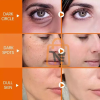 Woman face closeup before and after skincare treatment results Beauty Serum, Beauty Care, Skincare Product, Face Care, Acne Care, Skin Brightening, Facial Serum, Beauty & Health, Glow Skin, Skin Care Product