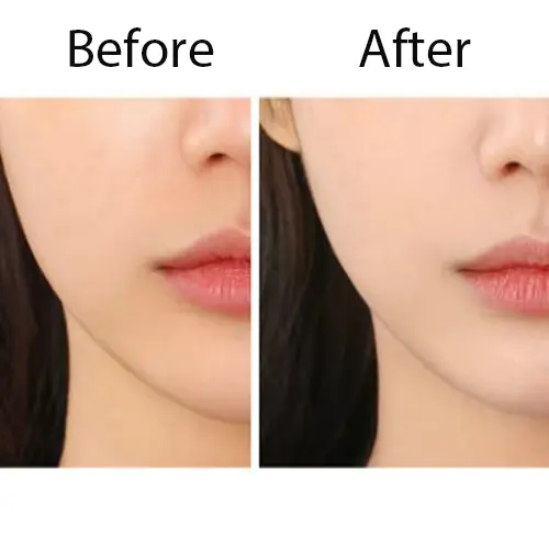 VEZE Gold Hyaluronic Acid Facial Mask moisturizing skincare sheet mask for glowing and hydrated skin